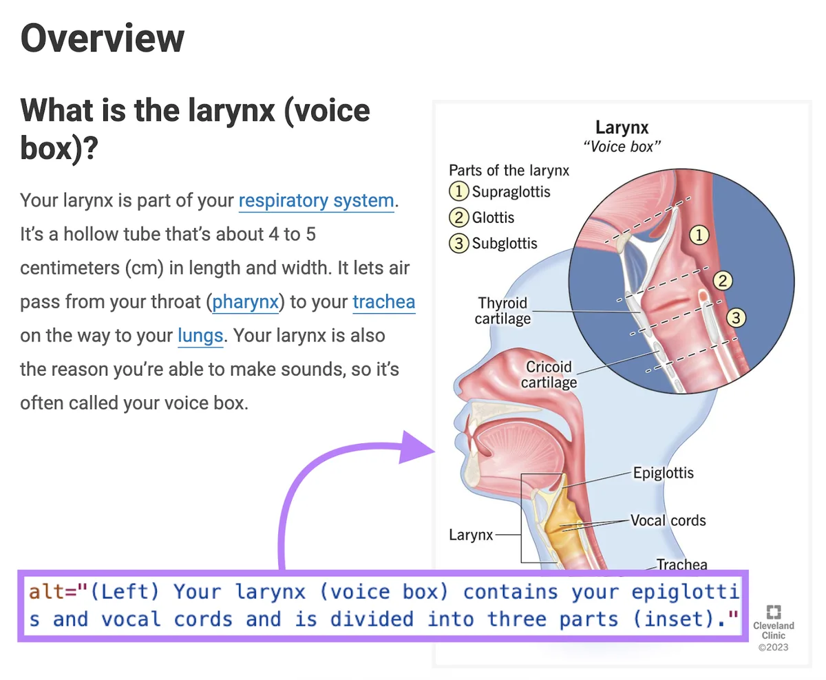 一张喉部示意图,其 alt 文本为:“你的喉(voice box)包含会厌和声带……”