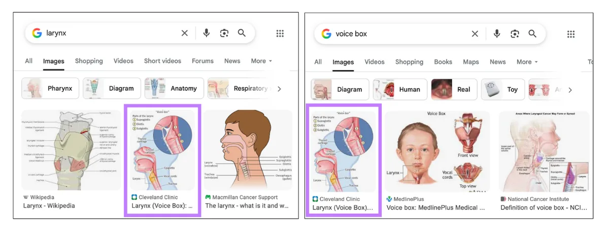 该图片同时出现在 larynx 和 voice box 的搜索结果中。